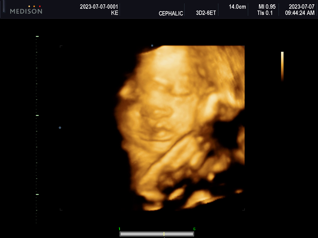 A Journey That Began at the End of the&nbsp;World